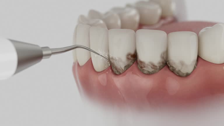 Reliable Dental contractor in Elkins, WV by Dentist Open Now